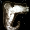 Elf foot X-ray