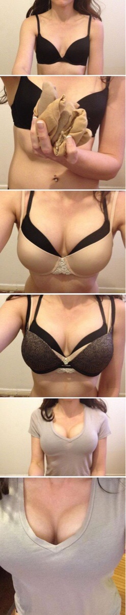 Breast enhancement
